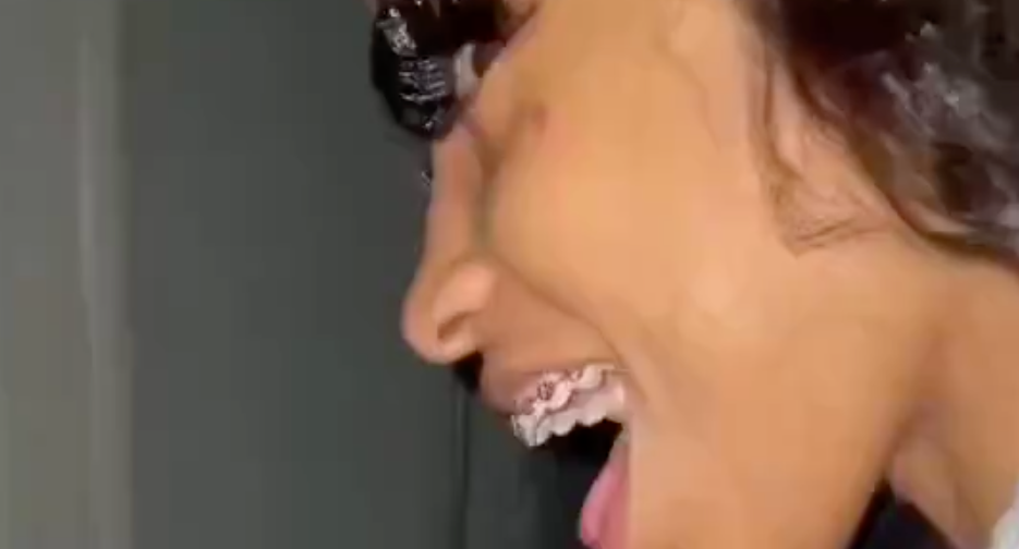 Slim Girl With Braces Suck on a Dick
